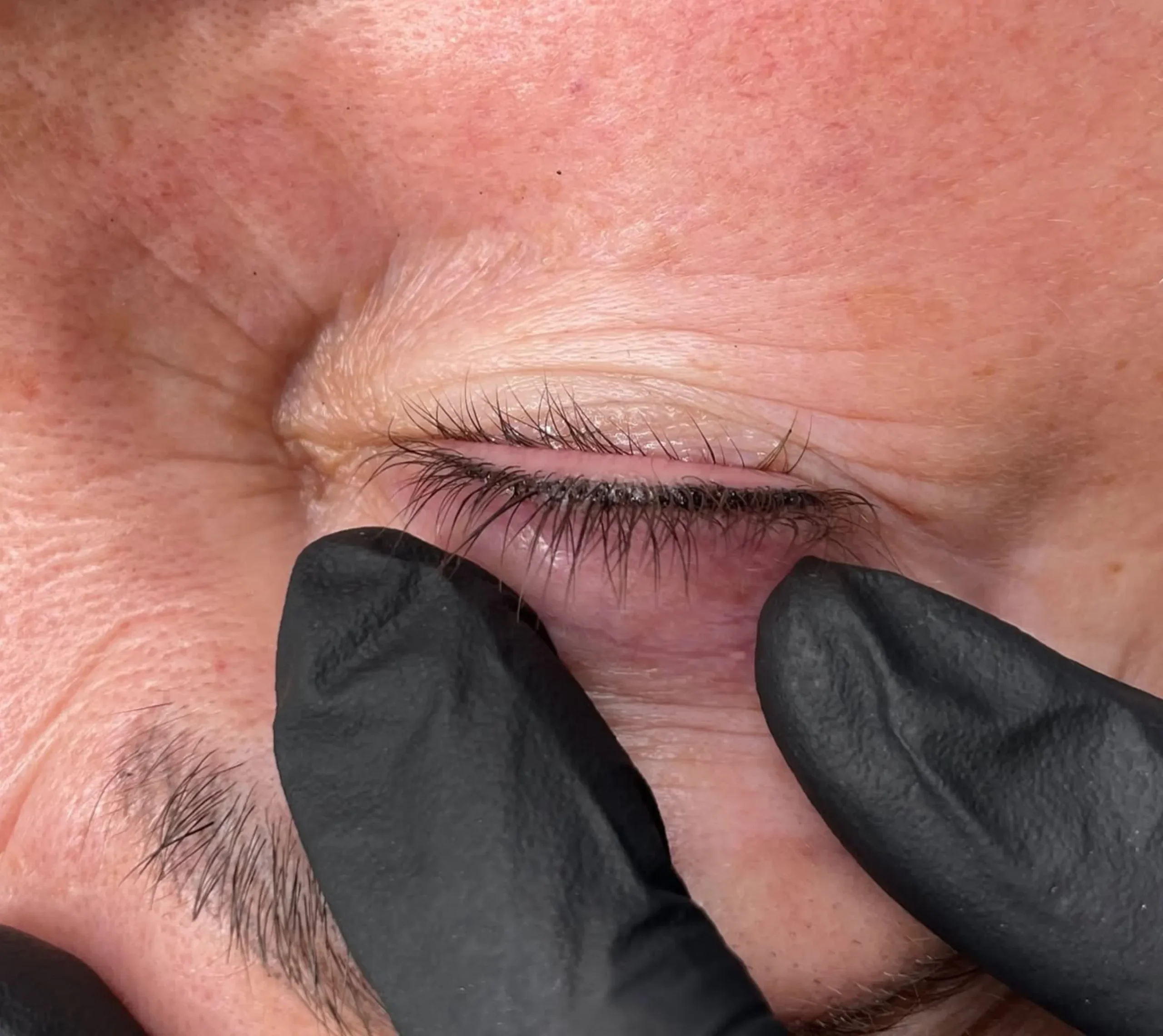 eyeliner tattoo healing timeline